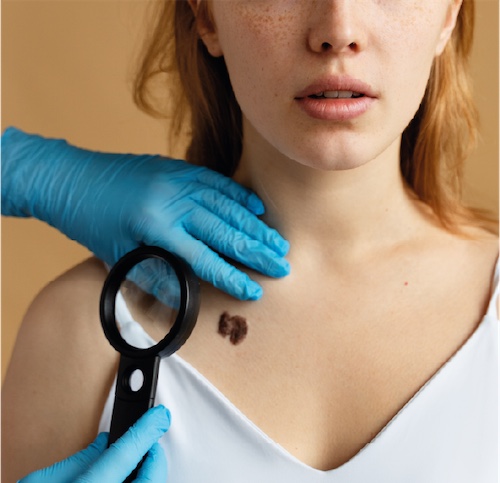 Dermatologia Cirurgica